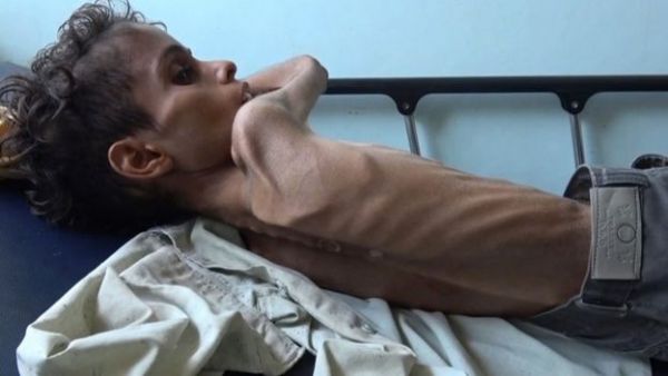 ديلي تلغراف: الوقت ينفد لإنهاء المجاعة في اليمن