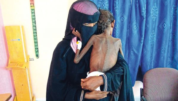 منظمة ألمانية تدعو لتتحسين وصول المساعدات للمتضررين في اليمن