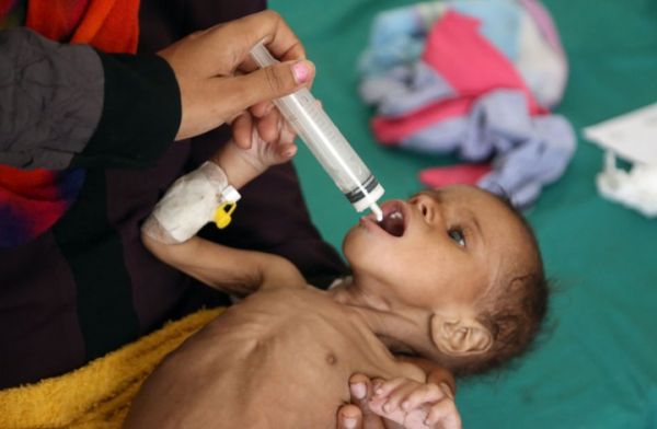 الأمم المتحدة: 400 يمني قضوا بسبب الكوليرا في 2018